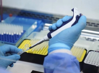 two suspected mpox patients shifted to hospital